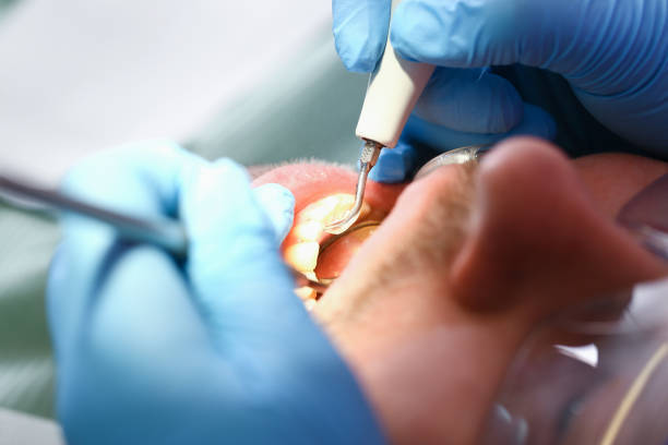 Best Urgent Tooth Repair  in Sylvania, GA