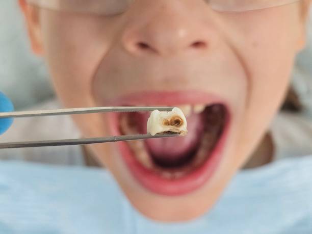Best Broken Tooth Emergency  in Sylvania, GA